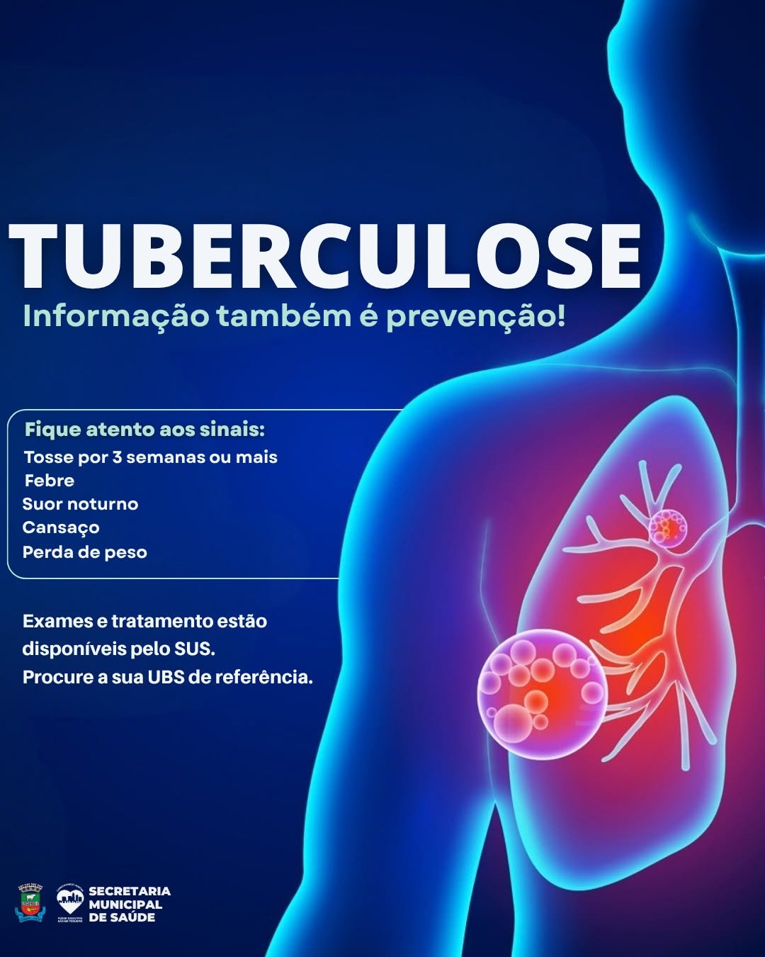 Imagem: Tuberculose: Fique atento aos sinais e cuide-se!